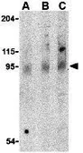 Anti-TLR5 antibody used in Western Blot (WB). GTX31724