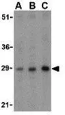 Anti-BCAP31 antibody used in Western Blot (WB). GTX31726