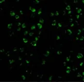 Anti-ASK1 antibody used in Immunocytochemistry/ Immunofluorescence (ICC/IF). GTX31727