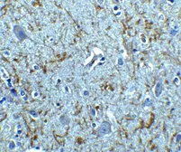 Anti-Clusterin antibody used in IHC (Paraffin sections) (IHC-P). GTX31733