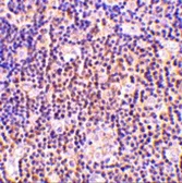 Anti-Bag1 antibody used in IHC (Paraffin sections) (IHC-P). GTX31737