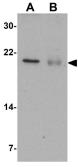 Anti-Bcl2A1 antibody used in Western Blot (WB). GTX31738