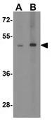 Anti-TANK antibody used in Western Blot (WB). GTX31740