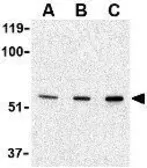 Anti-PAK2 antibody used in Western Blot (WB). GTX31743