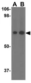 Anti-PKR antibody used in Western Blot (WB). GTX31746