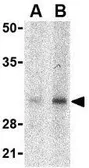 Anti-SLUG antibody used in Western Blot (WB). GTX31748