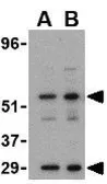 Anti-PDCD4 antibody used in Western Blot (WB). GTX31750