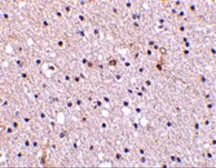 Anti-Nicastrin antibody used in IHC (Paraffin sections) (IHC-P). GTX31752