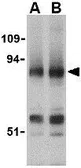 Anti-Blimp1 antibody used in Western Blot (WB). GTX31755