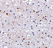 Anti-PD1 antibody used in IHC (Paraffin sections) (IHC-P). GTX31756