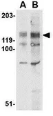 Anti-BUB1 antibody used in Western Blot (WB). GTX31758