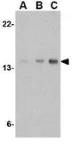 Anti-Stathmin 1 antibody used in Western Blot (WB). GTX31759