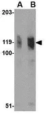 Anti-FYB antibody used in Western Blot (WB). GTX31762
