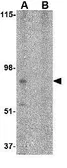 Anti-BRCC45 antibody used in Western Blot (WB). GTX31764