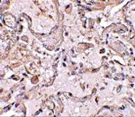 Anti-GSTP1 antibody used in IHC (Paraffin sections) (IHC-P). GTX31766