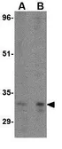Anti-ATG5 antibody used in Western Blot (WB). GTX31770