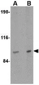 Anti-SATB2 antibody used in Western Blot (WB). GTX31773