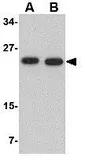 Anti-POFUT1 antibody used in Western Blot (WB). GTX31776