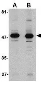 Anti-ALDH3A1 antibody used in Western Blot (WB). GTX31778