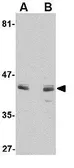 Anti-Activin Receptor Type IA antibody used in Western Blot (WB). GTX31779