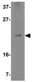 Anti-STK39 antibody used in Western Blot (WB). GTX31785