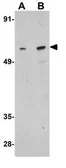 Anti-RUNX1 antibody used in Western Blot (WB). GTX31789