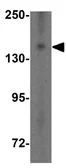 Anti-NPC1 antibody used in Western Blot (WB). GTX31790