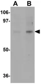Anti-ACBD3 antibody used in Western Blot (WB). GTX31794