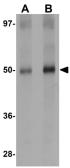 Anti-SQSTM1 / P62 antibody used in Western Blot (WB). GTX31795