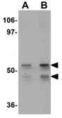 Anti-KLF4 antibody used in Western Blot (WB). GTX31798