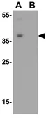 Anti-SAE1 antibody used in Western Blot (WB). GTX31803