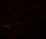Anti-SUMO3 antibody used in IHC (Paraffin sections) (IHC-P). GTX31805