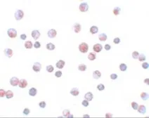 Anti-FOXO1 antibody used in Immunocytochemistry/ Immunofluorescence (ICC/IF). GTX31806