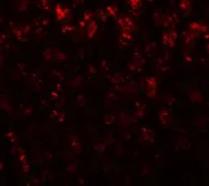 Anti-Alpha fetoprotein / AFP antibody used in IHC (Paraffin sections) (IHC-P). GTX31809