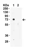 Anti-Alpha fetoprotein / AFP antibody used in Western Blot (WB). GTX31809
