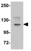 Anti-NOD1 antibody used in Western Blot (WB). GTX31810