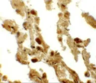 Anti-ESRP2 antibody used in IHC (Paraffin sections) (IHC-P). GTX31826