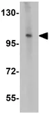 Anti-ZNF281 antibody used in Western Blot (WB). GTX31830