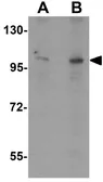 Anti-ZMIZ2 antibody used in Western Blot (WB). GTX31831
