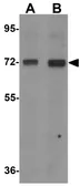 Anti-CD229 antibody used in Western Blot (WB). GTX31832