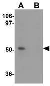 Anti-Protor-2 antibody used in Western Blot (WB). GTX31835