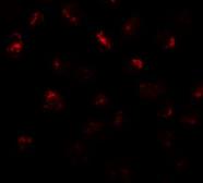 Anti-Protor-2 antibody used in Immunocytochemistry/ Immunofluorescence (ICC/IF). GTX31835