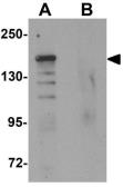 Anti-ROCK1 antibody used in Western Blot (WB). GTX31836