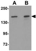 Anti-ROCK2 antibody used in Western Blot (WB). GTX31837