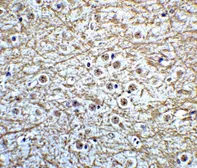 Anti-Musashi 2 antibody used in IHC (Paraffin sections) (IHC-P). GTX31838