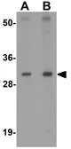 Anti-AP3S1 antibody used in Western Blot (WB). GTX31839