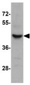 Anti-SLC35D3 antibody used in Western Blot (WB). GTX31842