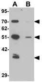 Anti-LAP2 antibody used in Western Blot (WB). GTX31844