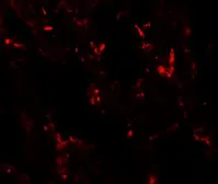 Anti-NKX2.1 antibody used in IHC (Paraffin sections) (IHC-P). GTX31847