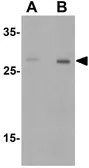 Anti-Dectin-1 antibody used in Western Blot (WB). GTX31853